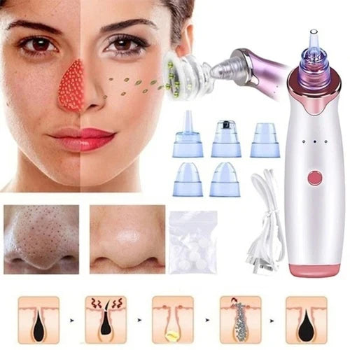 6-in-1 Handheld Vacuum Blackhead Remover and Pore Cleansing Tool