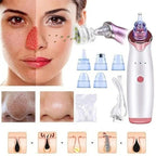 6-in-1 Handheld Vacuum Blackhead Remover and Pore Cleansing Tool