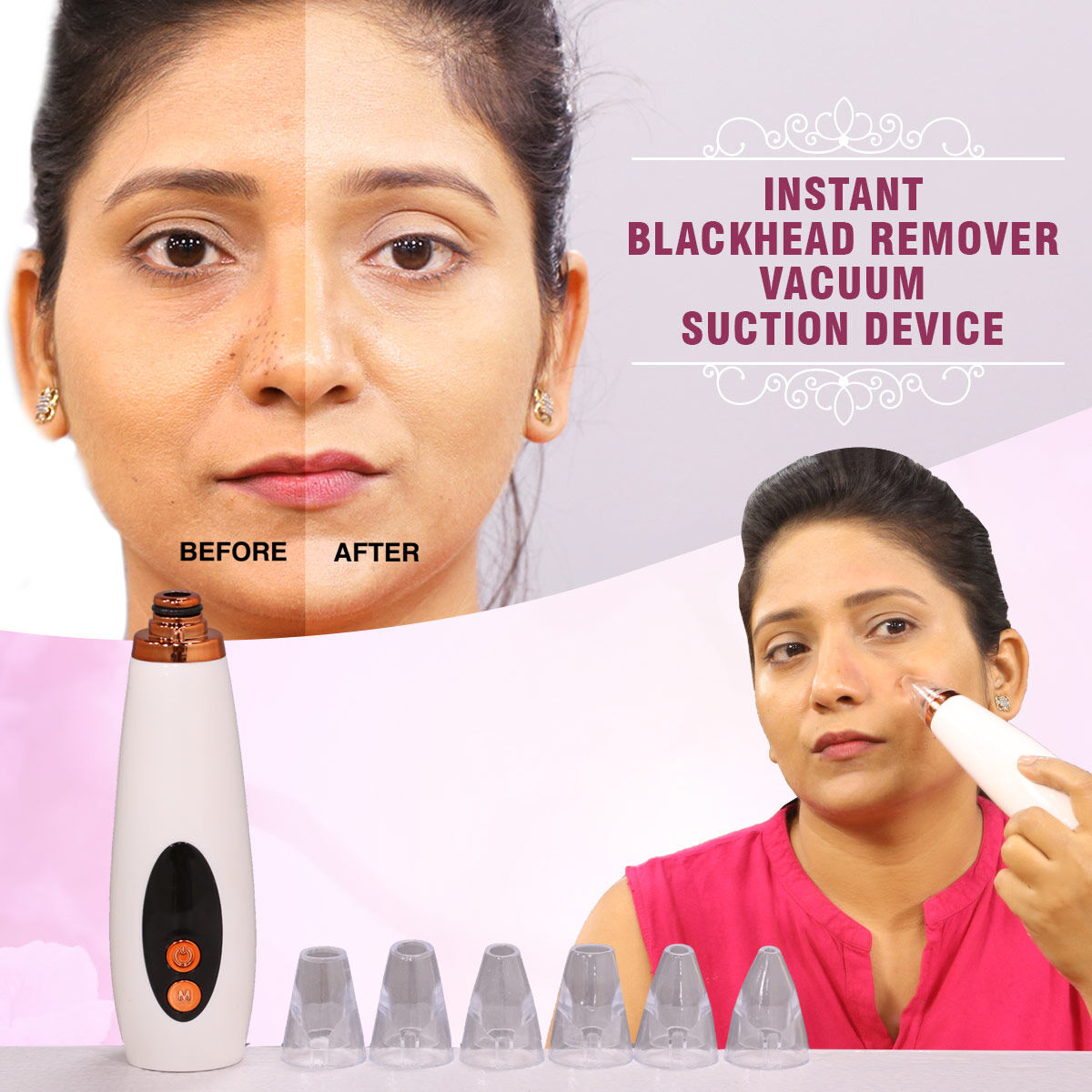 6-in-1 Handheld Vacuum Blackhead Remover and Pore Cleansing Tool