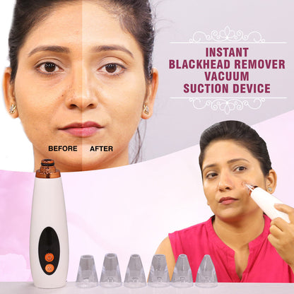 6-in-1 Handheld Vacuum Blackhead Remover and Pore Cleansing Tool